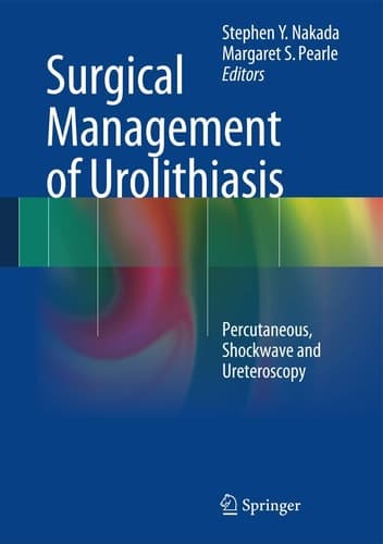 Surgical Management of Urolithiasis Percutaneous, Shockwave and Ureteroscopy