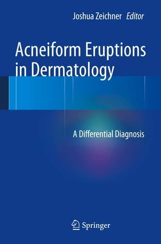 Acneiform Eruptions in Dermatology A Differential Diagnosis