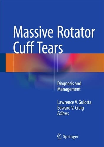 Massive Rotator Cuff Tears Diagnosis and Management
