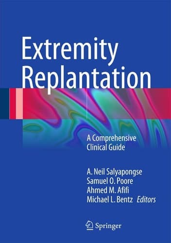 Extremity Replantation A Comprehensive Clinical Guide