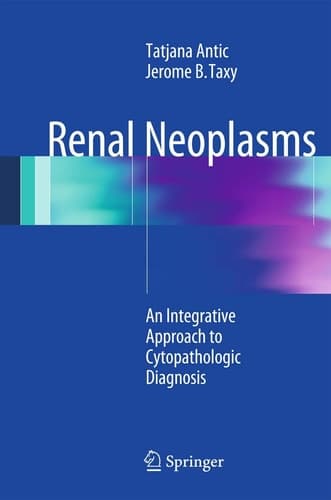 Renal Neoplasms An Integrative Approach To Cytopathologic Diagnosis