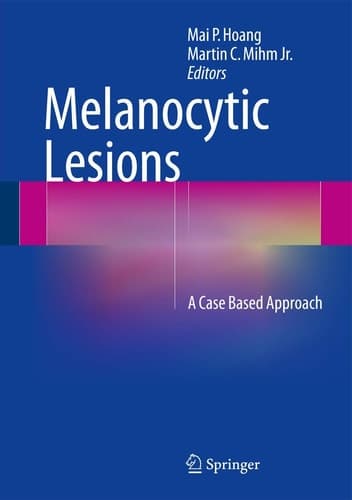 Melanocytic Lesions A Case Based Approach