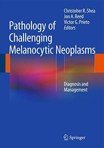 Pathology of Challenging Melanocytic Neoplasms Diagnosis and Management
