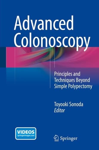 Advanced Colonoscopy Principles and Techniques Beyond Simple Polypectomy