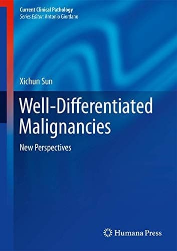 Well-Differentiated Malignancies New Perspectives