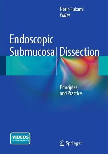 Endoscopic Submucosal Dissection Principles and Practice