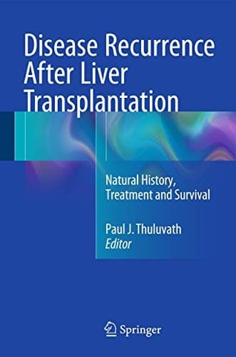 Disease Recurrence After Liver Transplantation Natural History, Treatment and Survival