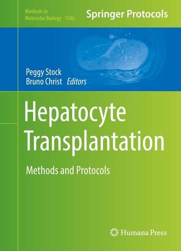 Hepatocyte Transplantation Methods and Protocols