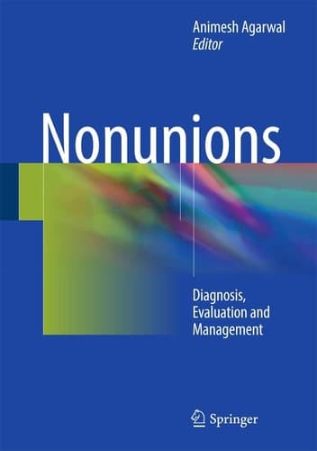 Nonunions Diagnosis, Evaluation and Management