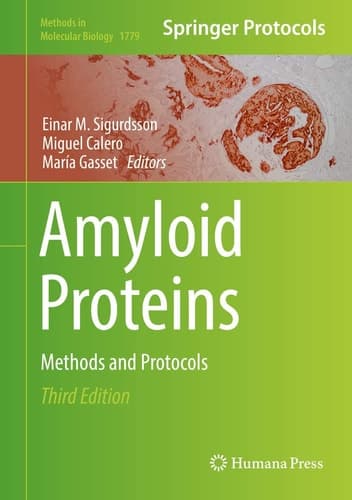 Amyloid Proteins Methods and Protocols