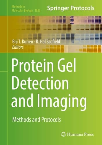 Protein Gel Detection and Imaging Methods and Protocols