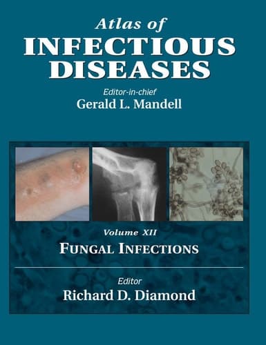 Fungal Infections