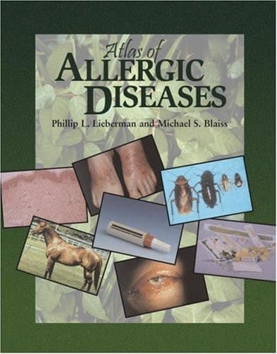 Atlas of Allergic Diseases
