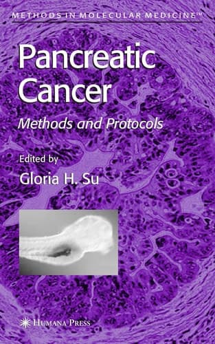 Pancreatic Cancer Methods and Protocols
