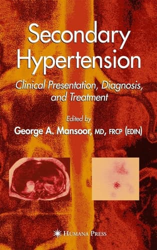 Secondary Hypertension: Clinical Presentation, Diagnosis, and Treatment (Clinical Hypertension and Vascular Diseases)