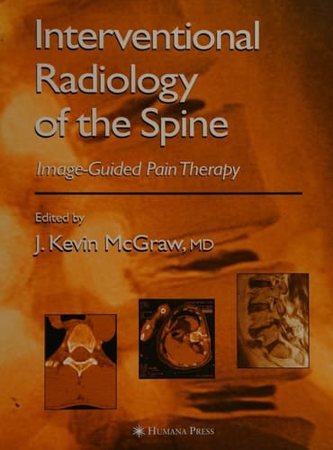 Interventional Radiology of the Spine: Image-Guided Pain Therapy