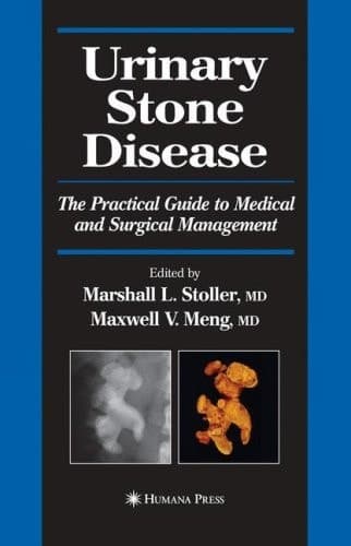 Urinary Stone Disease The Practical Guide to Medical and Surgical Management