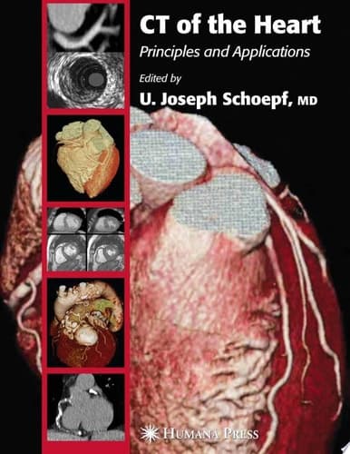 CT of the Heart Principles and Applications