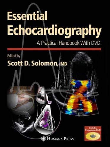 Essential Echocardiography: A Practical Handbook with DVD (Contemporary Cardiology)