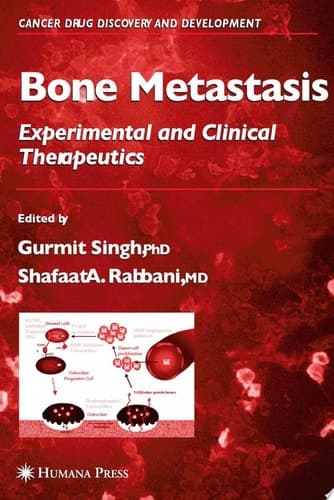 Bone Metastasis