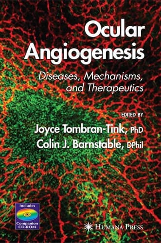 Ocular Angiogenesis Diseases, Mechanisms, and Therapeutics