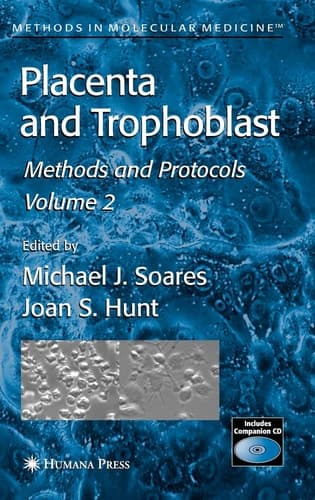 Placenta and Trophoblast: Methods and Protocols, Volume II (Methods in Molecular Medicine) (Methods in Molecular Medicine, 122)