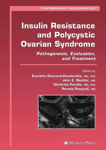 Insulin Resistance and Polycystic Ovarian Syndrome Pathogenesis, Evaluation, and Treatment