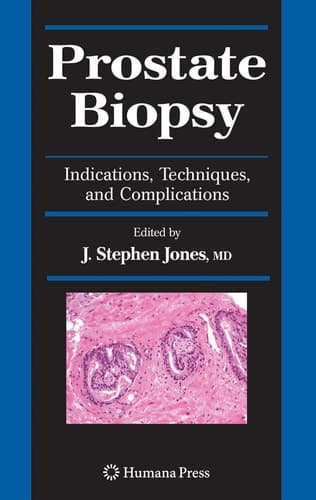 Prostate Biopsy Indications, Techniques, and Complications
