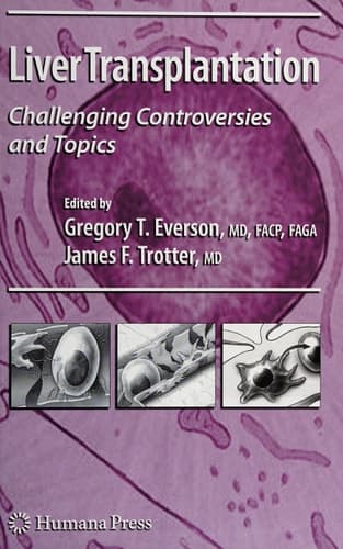 Liver Transplantation Challenging Controversies and Topics