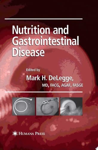 Nutrition and Gastrointestinal Disease