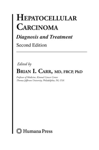 Hepatocellular Carcinoma Diagnosis and Treatment