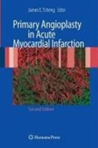 Primary Angioplasty in Acute Myocardial Infarction