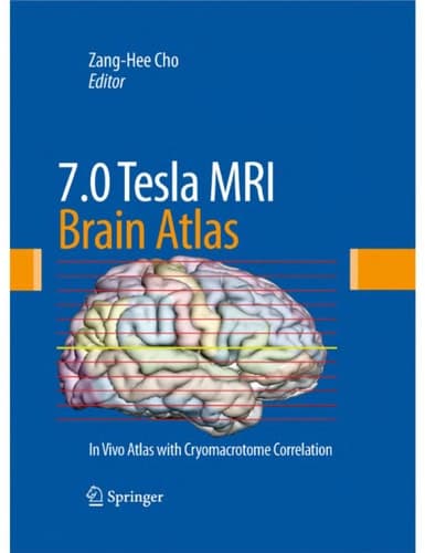 7.0 Tesla MRI Brain Atlas In Vivo Atlas with Cryomacrotome Correlation
