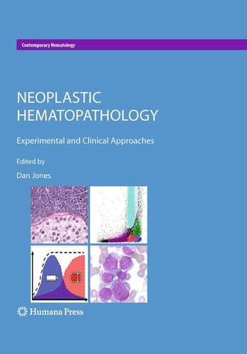 Neoplastic Hematopathology Experimental and Clinical Approaches