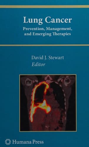 Lung Cancer: Prevention, Management, and Emerging Therapies