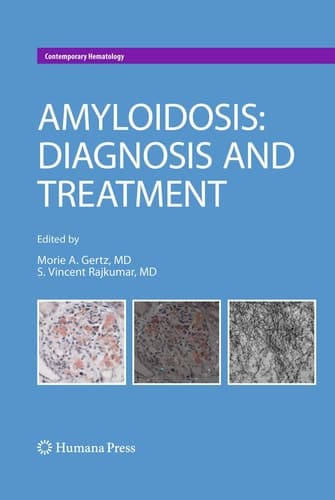 Amyloidosis Diagnosis and Treatment