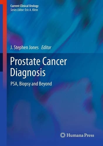 Prostate Cancer Diagnosis PSA, Biopsy and Beyond