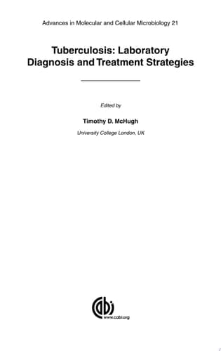 Tuberculosis Diagnosis and Treatment