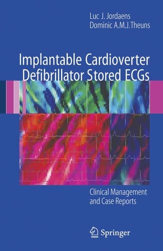 Implantable Cardioverter Defibrillator Stored ECGs Clinical Management and Case Reports
