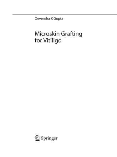 Microskin Grafting for Vitiligo