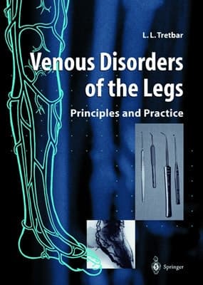 Venous Disorders of the Legs: Principles and Practice