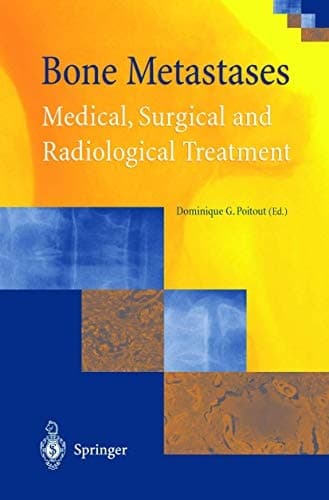 Bone Metastases Medical, Surgical and Radiological Treatment