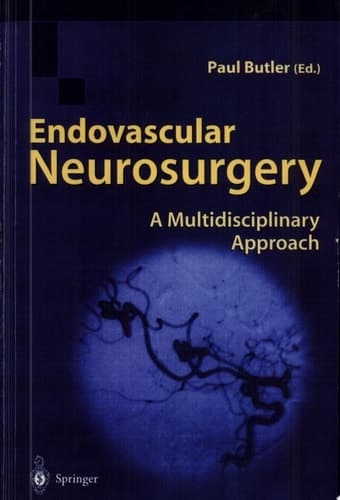 Endovascular Neurosurgery A Multidisciplinary Approach