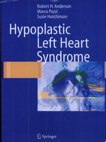Hypoplastic Left Heart Syndrome