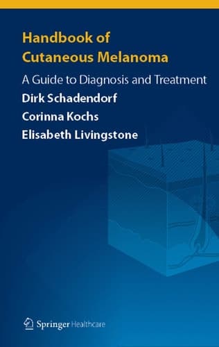 Handbook of Cutaneous Melanoma A Guide to Diagnosis and Treatment