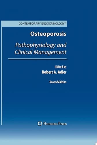 Osteoporosis Pathophysiology and Clinical Management