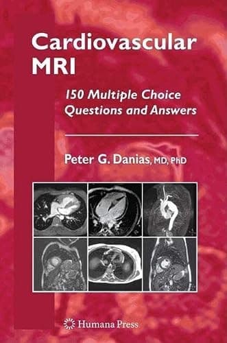 Cardiovascular MRI 150 Multiple-Choice Questions and Answers