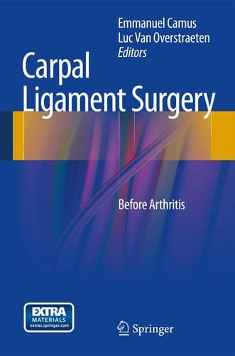 Carpal Ligament Surgery Before Arthritis