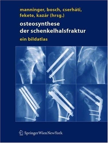 Osteosynthese der Schenkelhalsfraktur Ein Bildatlas