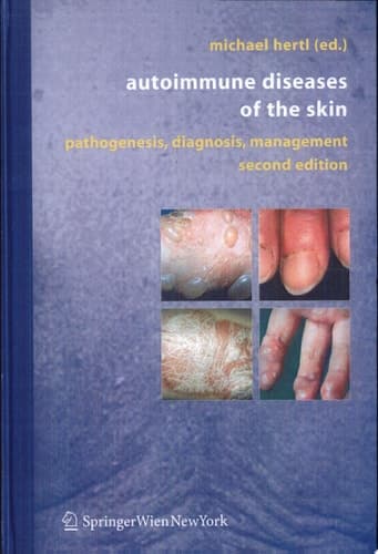 Autoimmune Diseases of the Skin Pathogenesis, Diagnosis, Management